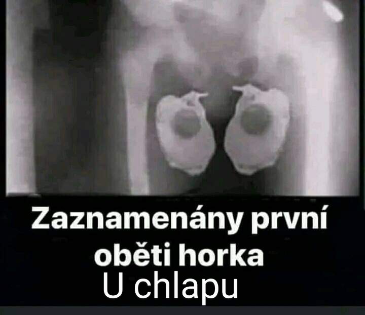 kliknutím fotku zvětšíte