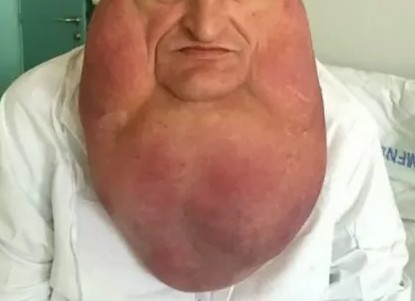 kliknutím fotku zvětšíte